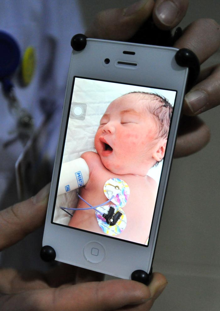 Lu Yuanfang, who suffers from spinal muscular atrophy, gives birth to a premature boy in Beijing, Jan. 30, 2013. The birth marked a medical first in China. (Xinhua/Li Wen)