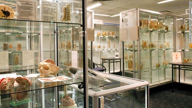 Museum of Human Disease, Australia (Photo Source: huanqiu.com)